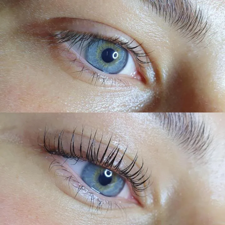 Rezultat before / after la laminare de gene